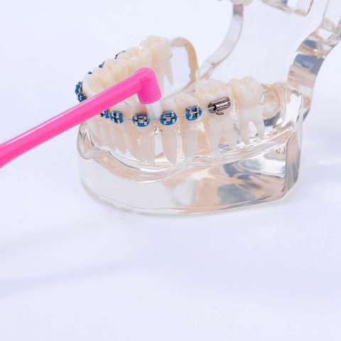 Dental orthodontic small head tip single beam head soft bristles implant brush braces cleaning interdental toothbrush